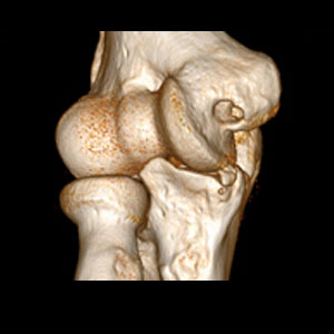 MRI, body scan technology medical imaging body scans advanced technology healthy