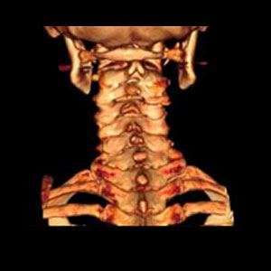 MRI- body scan-technology-medical imaging-body scans-advanced technology-healthy-analysis